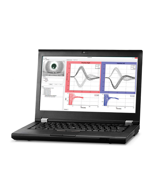 비디오충동검사 vHIT 장비 사진