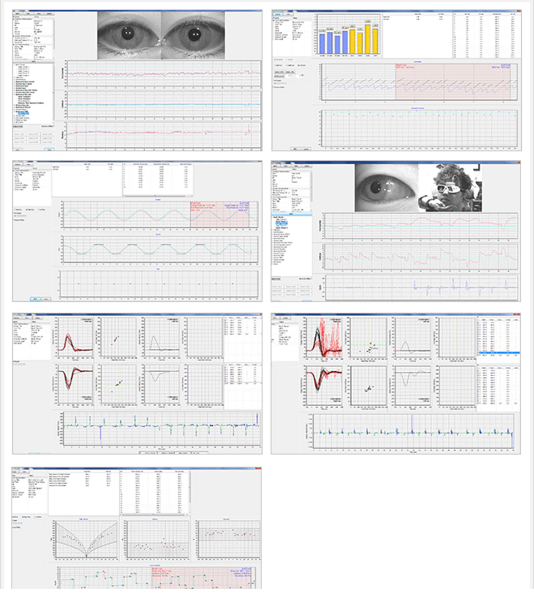 비디오안진검사 VNG 장비 사진