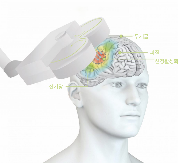경두개자기자극기 치료시 활성화되는 신경과 두개골, 피질을 표현한 인체 두상 이미지