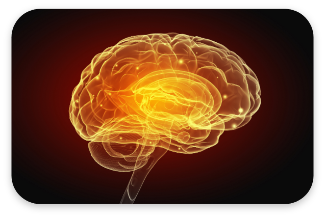 뇌질환 대표 이미지