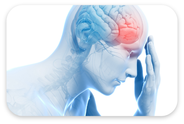 편두통 대표 이미지