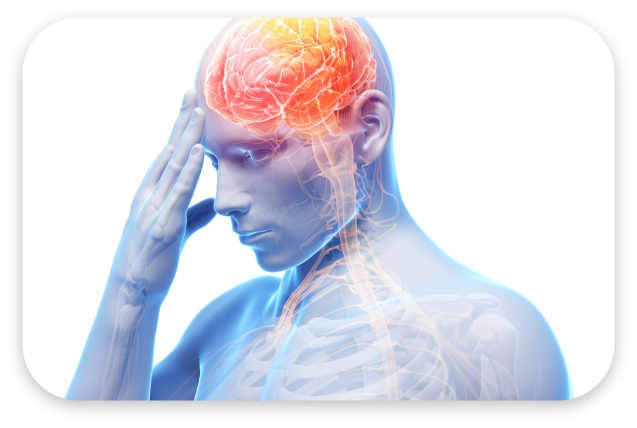 군발성 두통 대표 이미지