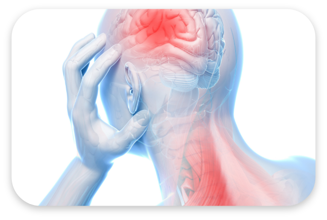 경추성 두통 대표 이미지