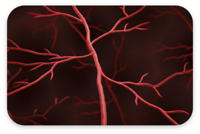 혈관성 치매 대표 이미지