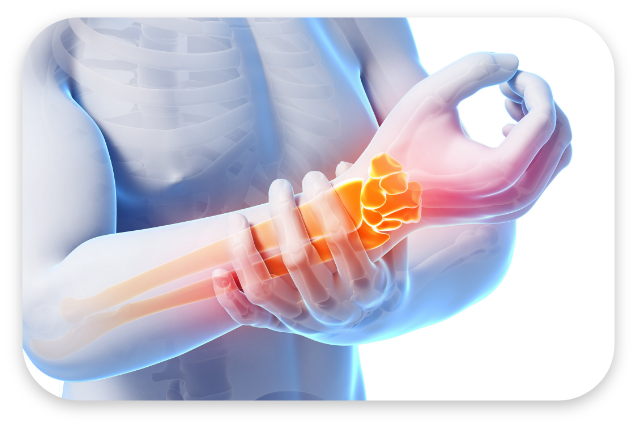 팔꿈치/손목 대표 이미지