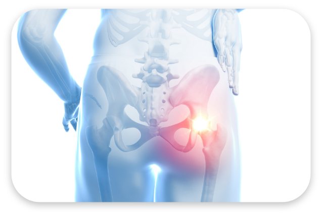 골반 대표 이미지