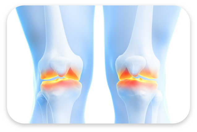 무릎/발 대표 이미지